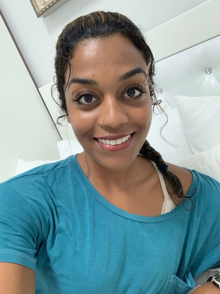 Amanda smiles with clearer, happier skin .